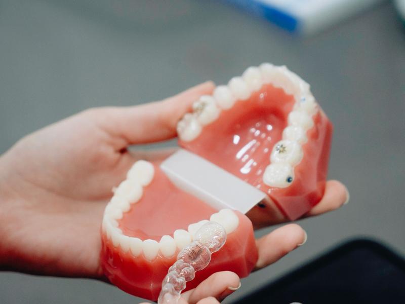 Hands holding a clear dental aligner above a model of teeth